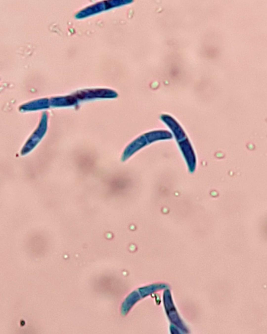 Conidii Microdochium nivale